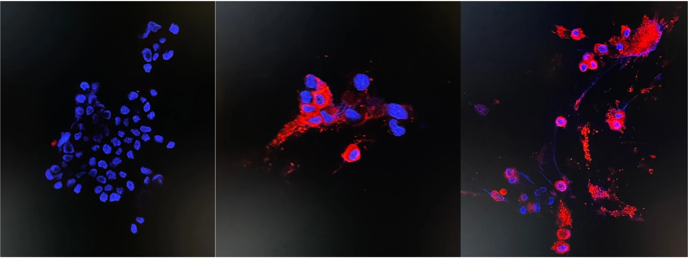 Omicron variant isolated by HKU microbiology research team