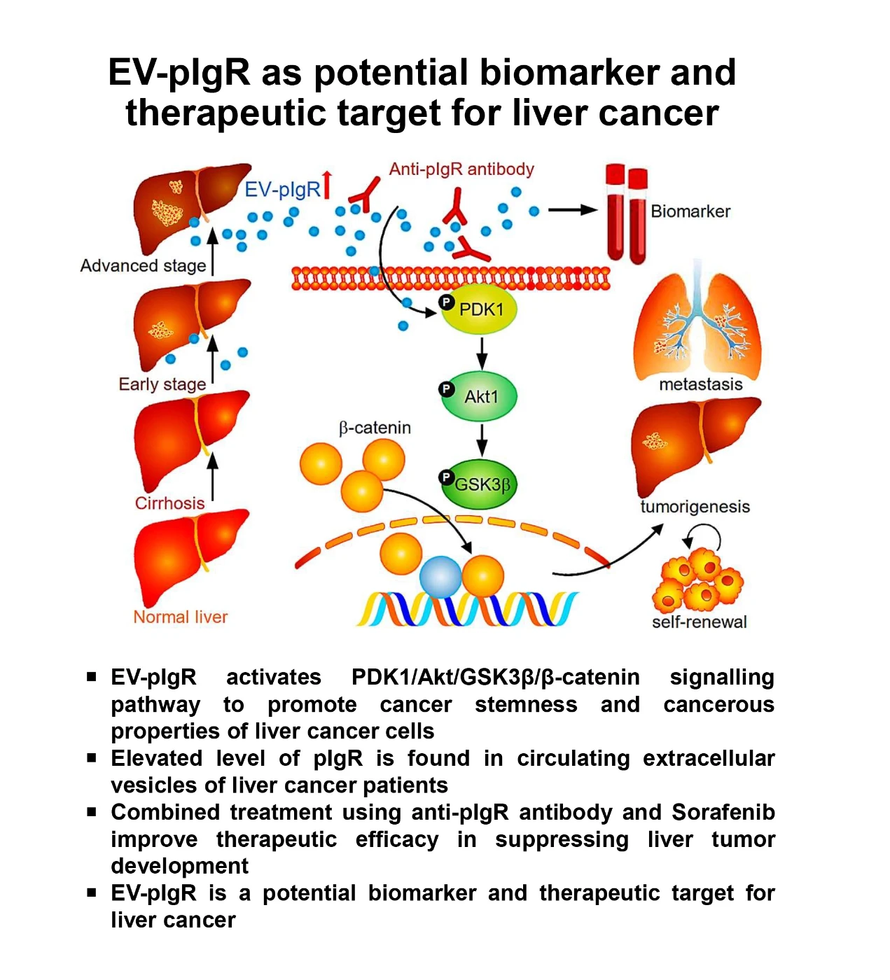 HKUMed researchers identified a key molecule in extracellular vesicles of liver cancer patient as a potential new biomarker  for early diagnosis and therapeutic target