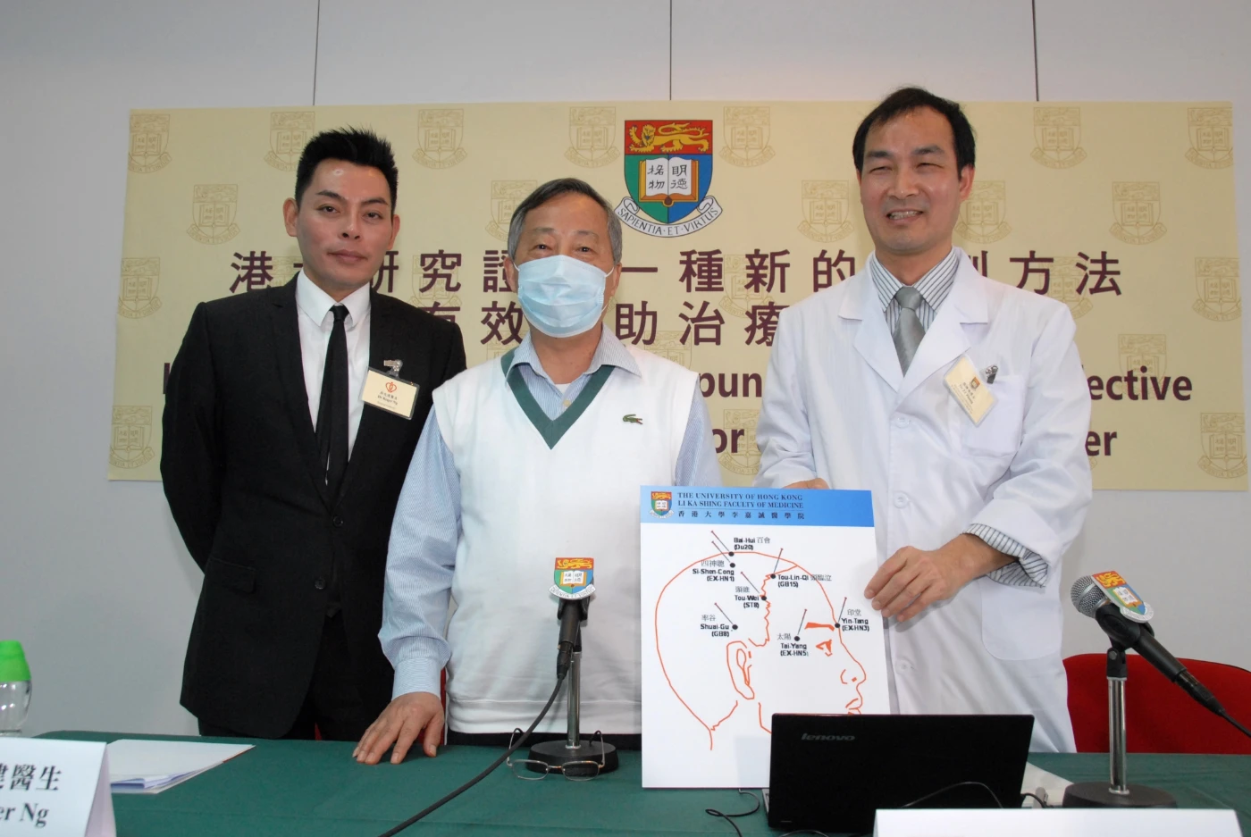港大研究證實一種新的針刺方法能有效輔助治療抑鬱症