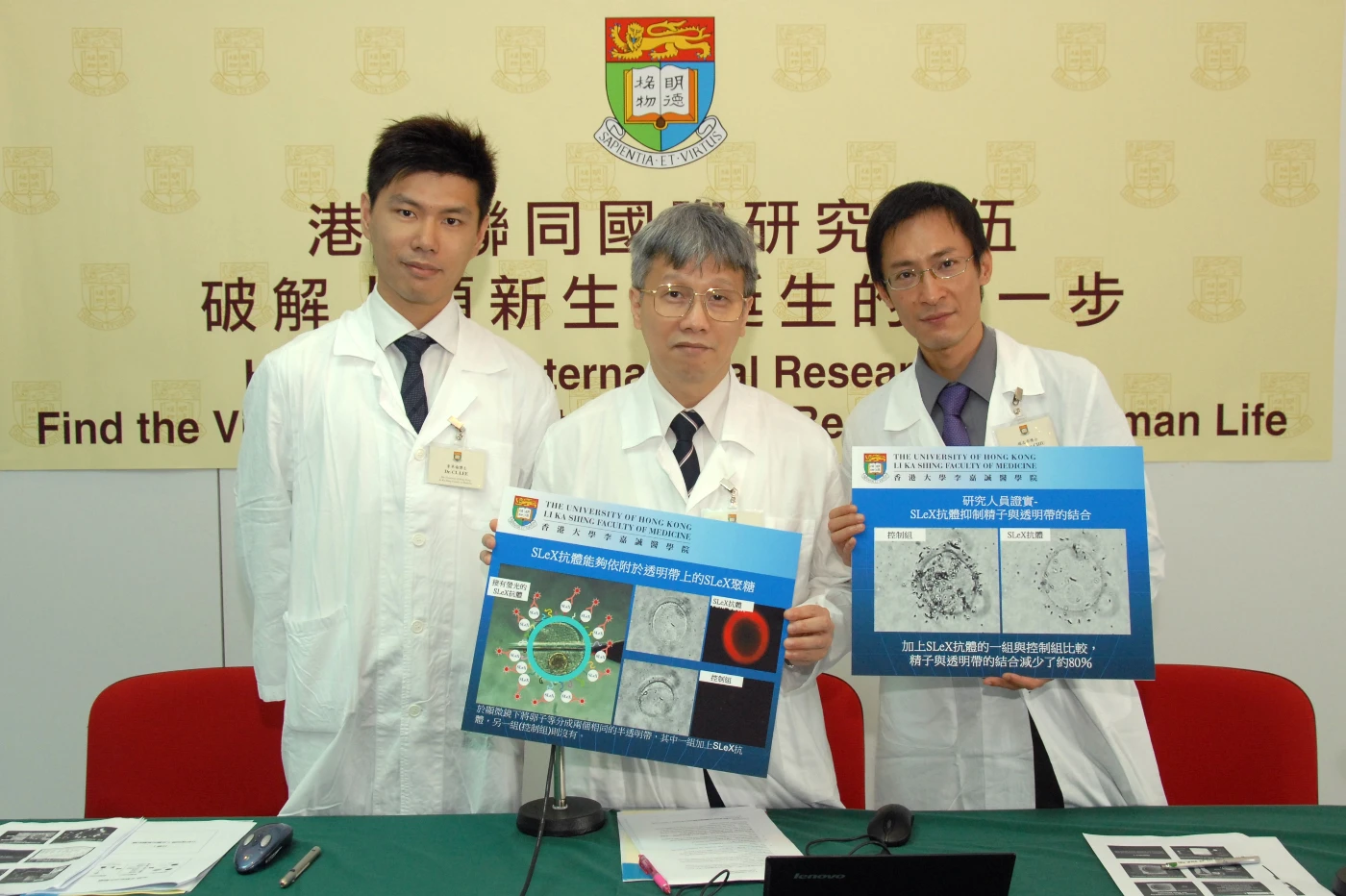 港大聯同國際研究隊伍發現令人類精子及卵子結合的關鍵分子破解人類新生命誕生的第一步