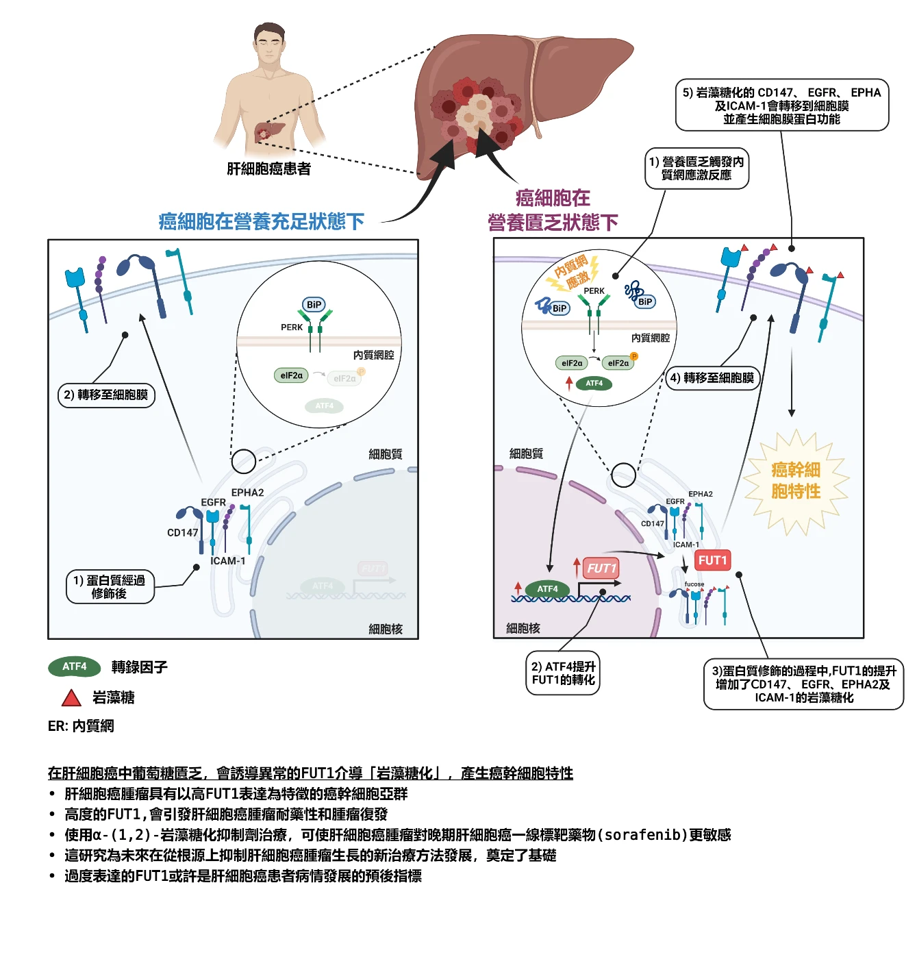 HKUMed researchers unveil a novel molecular mechanism underlying liver cancer drug resistance and tumour recurrence