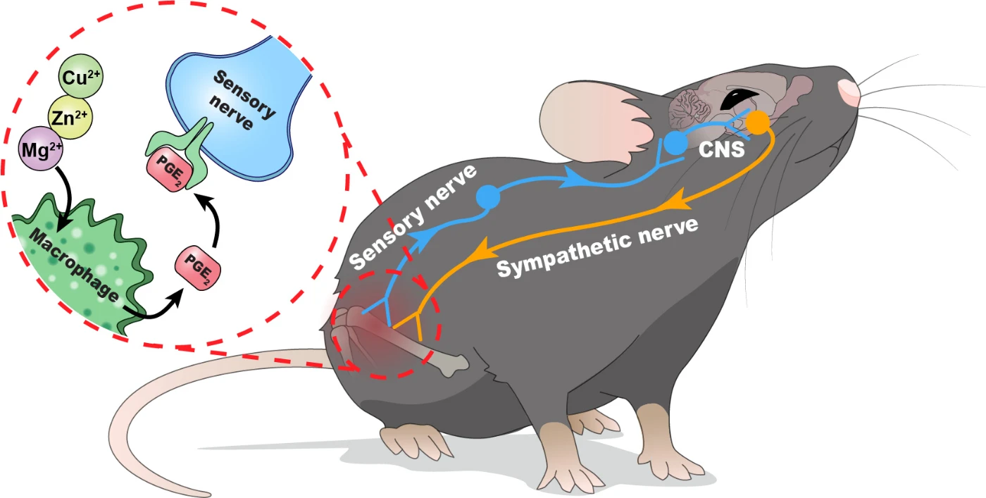 HKUMed and JHU teams jointly discover <br>
the role of central nervous system in the control of bone healing <br>
in response to stimulation of metal ions