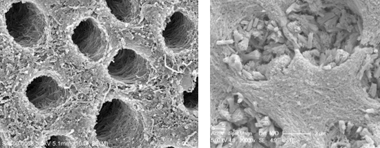 Dental researchers at HKU and Anhui Medical University apply mussel power to fortify teeth