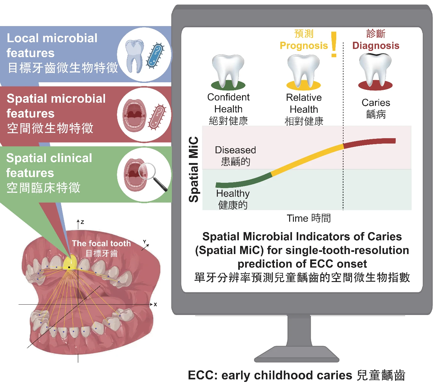港大牙醫學院開發全球首個人工智能系統<br>
以微生物特徵預測兒童早期單顆牙齒蛀牙風險 準確率逾九成