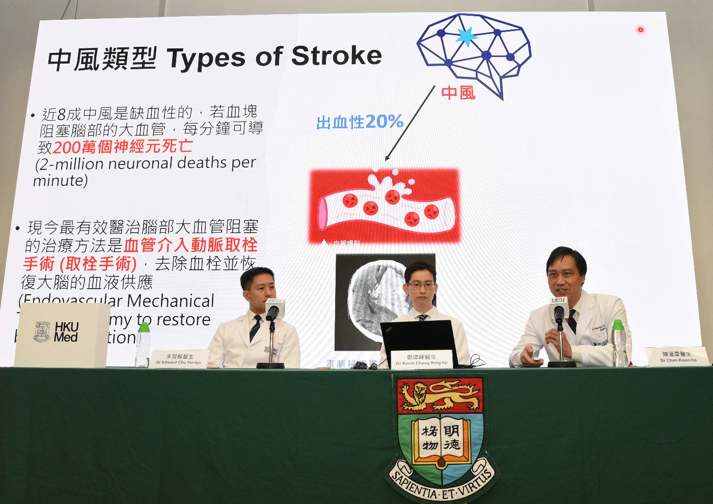 （右起）陳灌豪醫生、鄭璟暉醫生和朱賢麟醫生公布研究成果，擴大中風治療黃金期由六小時至廿四小時，將惠及更多病人。
