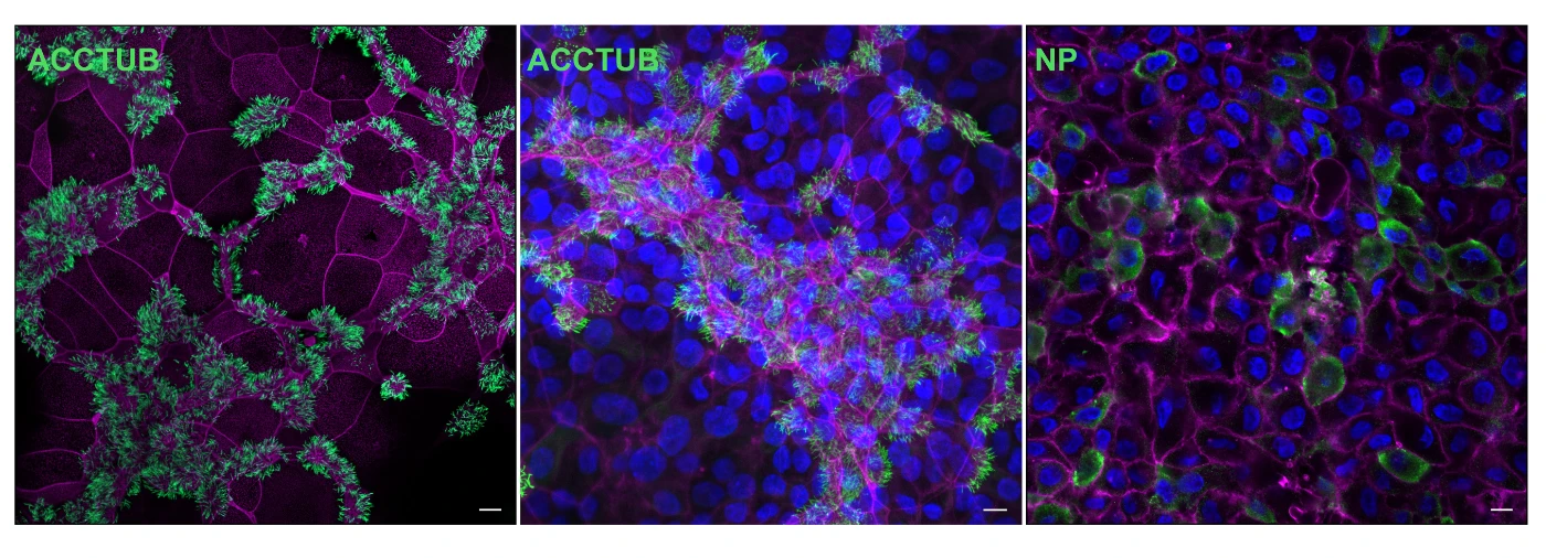 Confocal images of the abundant cells (left and middle) and the H7N9 virus infected (right) cells in the 2D mature airway organoids. Nuclei and cellular actin filaments were counter-stained in blue and purple.