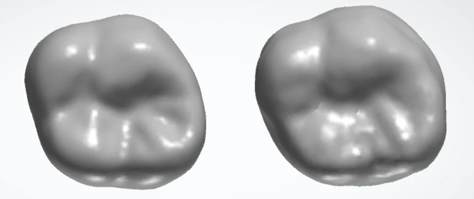 Natural tooth (left) compared with tooth tailored by generative AI  (right)