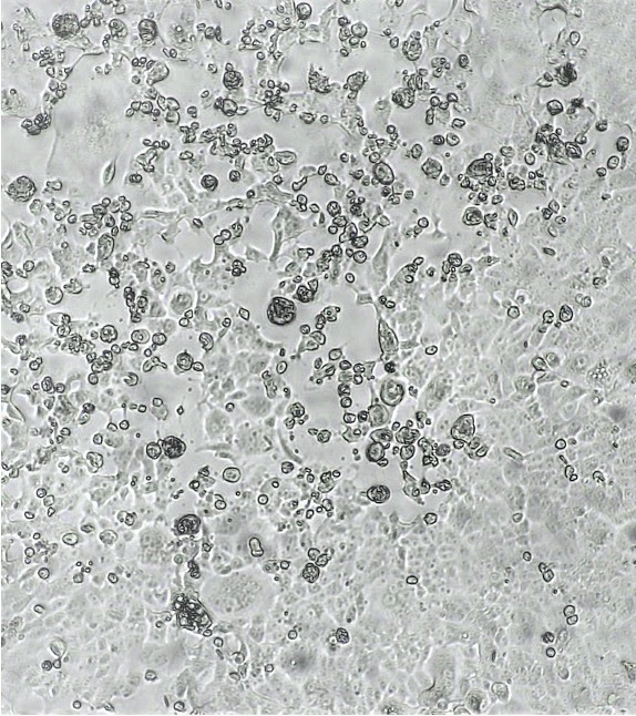 HKU microbiologists find that two doses of BNT162b2 (BioNTech ) or  Coronavac (Sinovac) vaccines are inadequate against Omicron virus variants