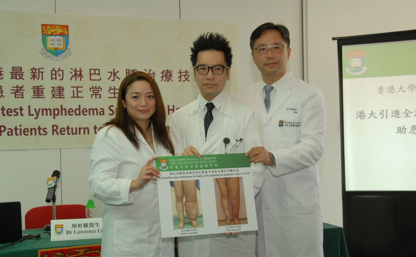 HKU Introduces the Latest Lymphedema Surgery to Hong Kong <br>
and Helps Patients Return to Normal Life