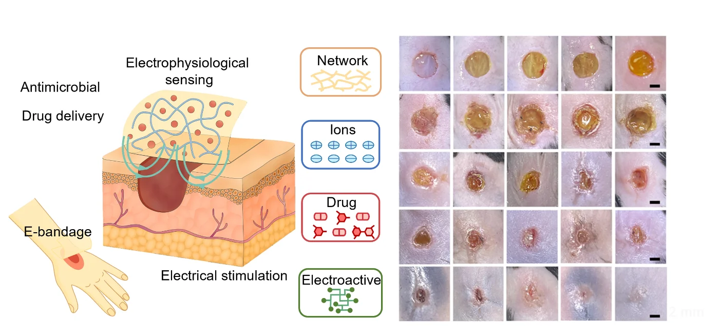 Ionogel-enabled electronic bandage for wound healing applications.