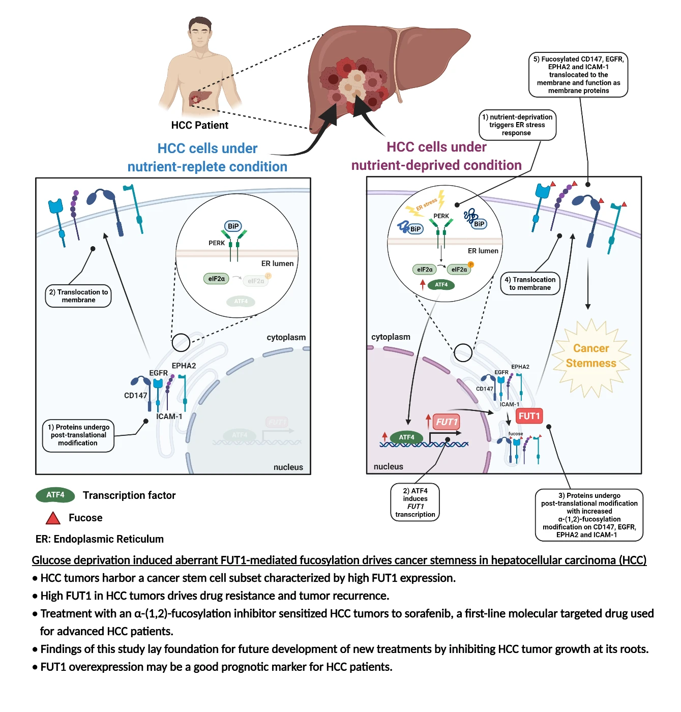 HKUMed researchers unveil a novel molecular mechanism underlying liver cancer drug resistance and tumour recurrence