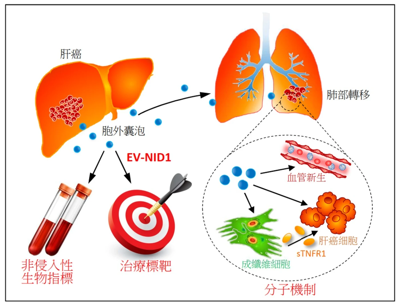 香港大學李嘉誠醫學院（港大醫學院）研究團隊發現，肝癌細胞來源的胞外囊泡（EVs）加促了腫瘤的生長和向肺部轉移。這項嶄新發現為肝癌治療提供了新的生物指標及治療方向。