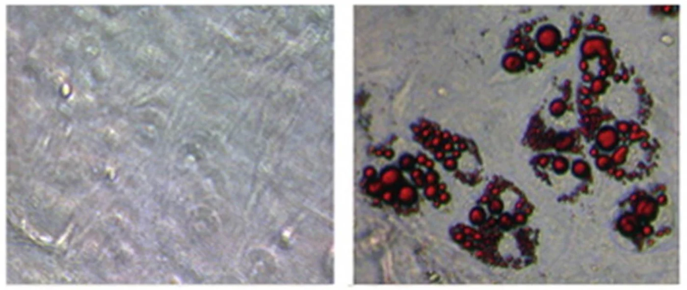 Zfp516 protein triggers "browning" of white fat (photo on right, O red oil staining indicating presence of brown fat)